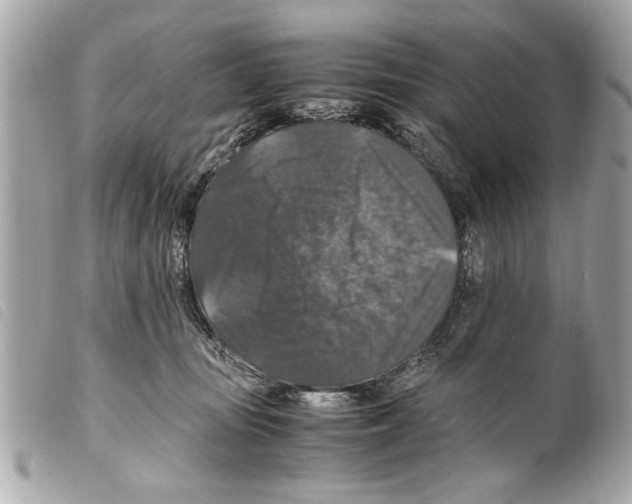 X0000099290371200805301117