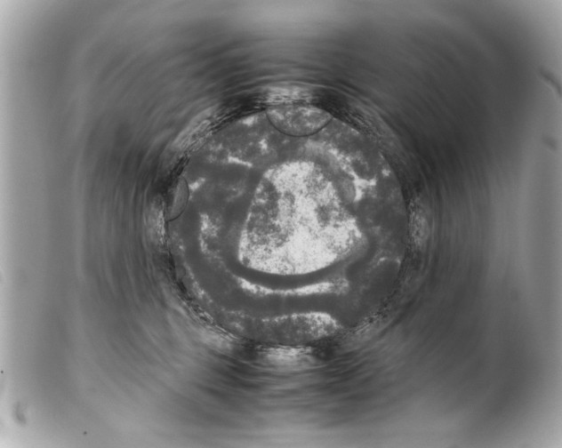 X0000099290375200805301117