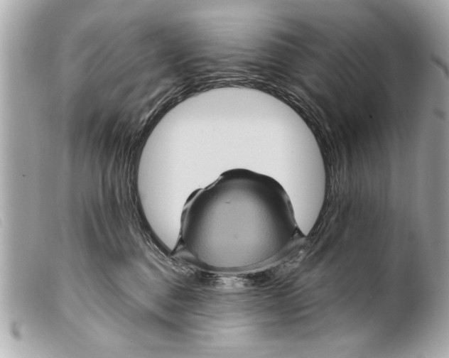 X0000099290376200805301117