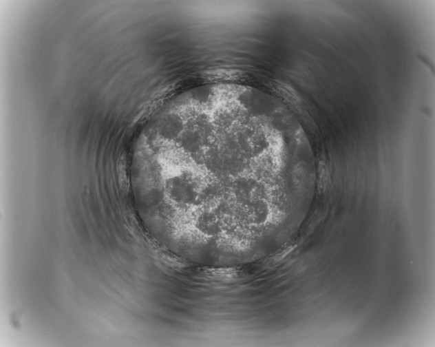 X0000099290377200805301117
