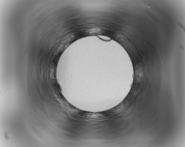 X0000099290379200805301117