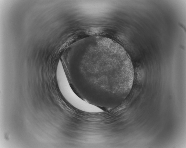 X0000099290380200805301117