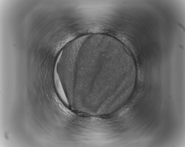 X0000099290393200805301116