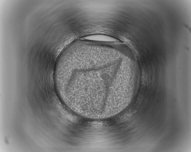 X0000099290394200805301116