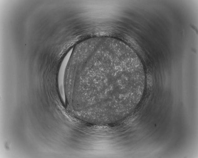 X0000099290401200805301116
