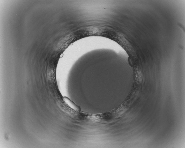 X0000099290419200805301116