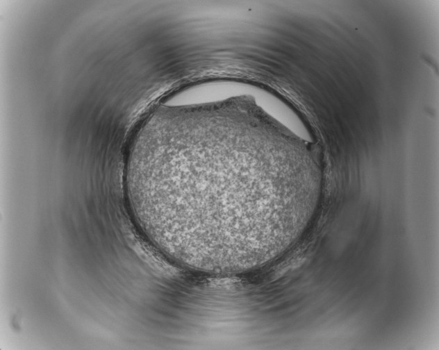 X0000099290446200805301115