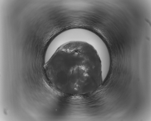 X0000099290451200805301115