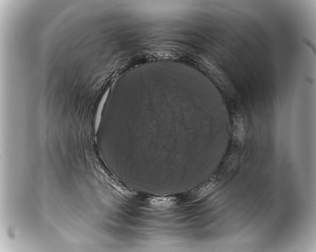 X0000099290465200805301116