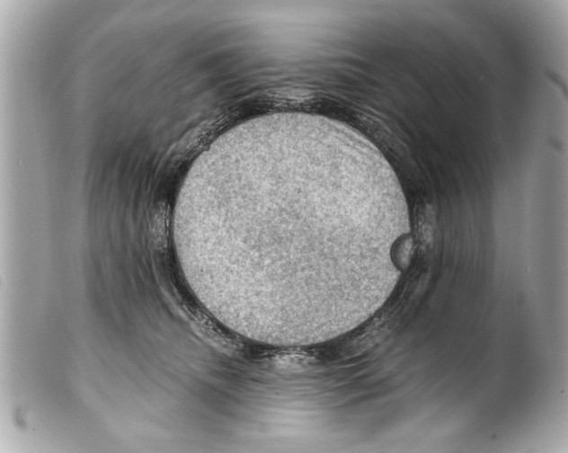 X0000099290468200805301116