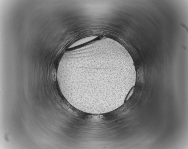 X0000099290474200805301116