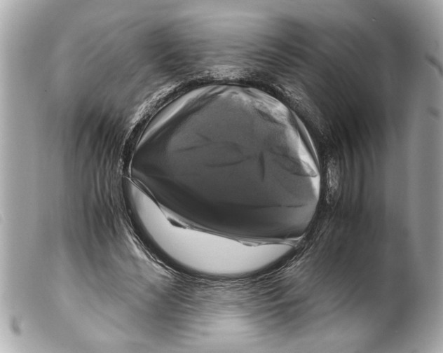 X0000099290492200805301115