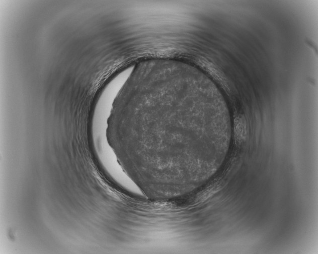X0000099290493200805301115