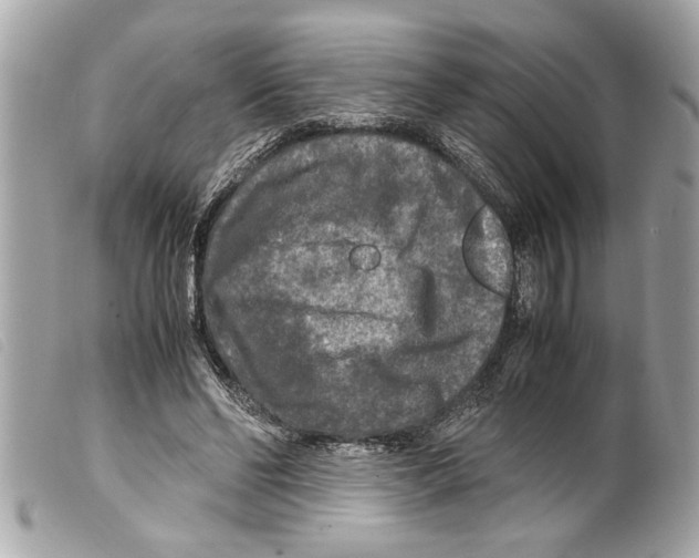 X0000099290494200805301115
