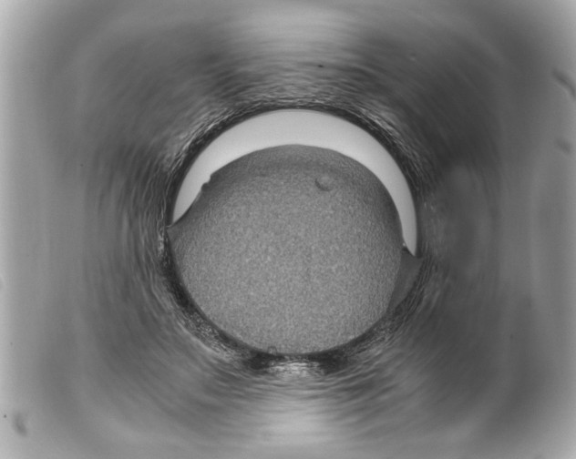 X0000099290499200805301115