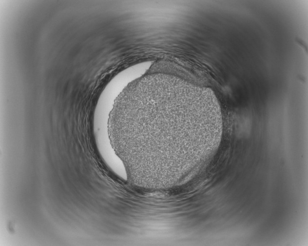 X0000099290511200805301115