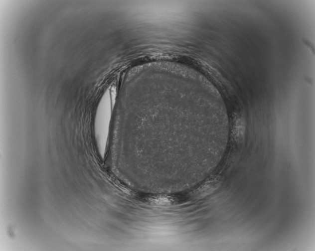 X0000099290513200805301115