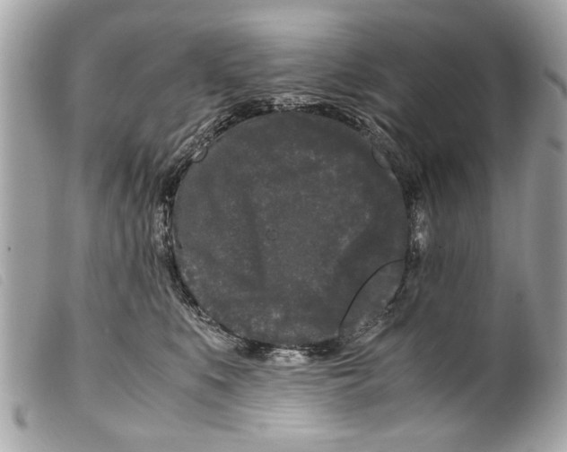 X0000099290519200805301114