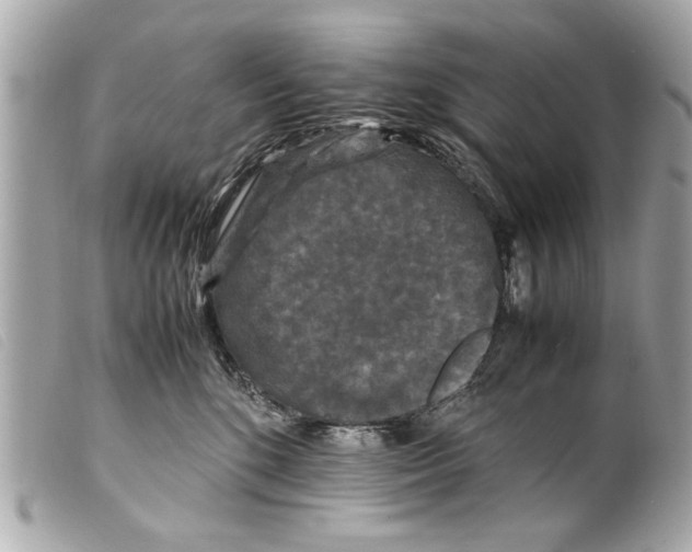 X0000099290520200805301114