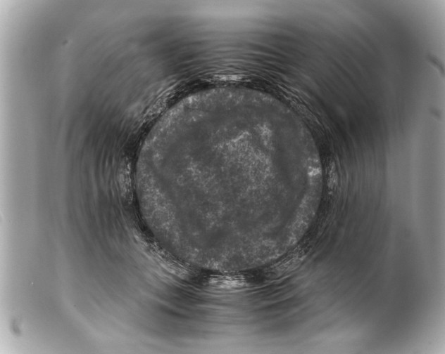 X0000099290559200805301114