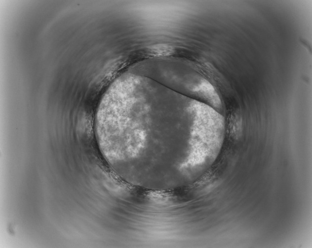 X0000099290568200805301114