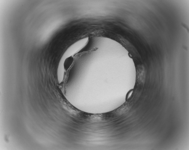 X0000099290574200805301114