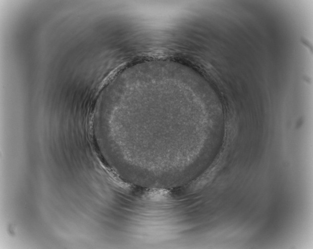 X0000099290576200805301114