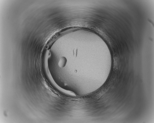 X0000099290580200805301114