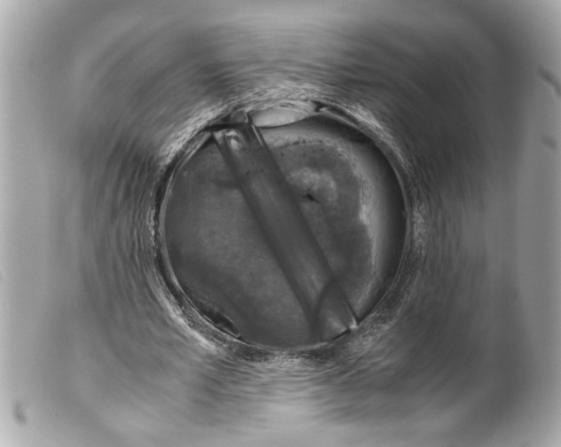 X0000099290581200805301114