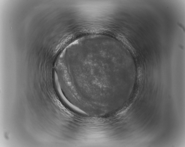 X0000099290585200805301114