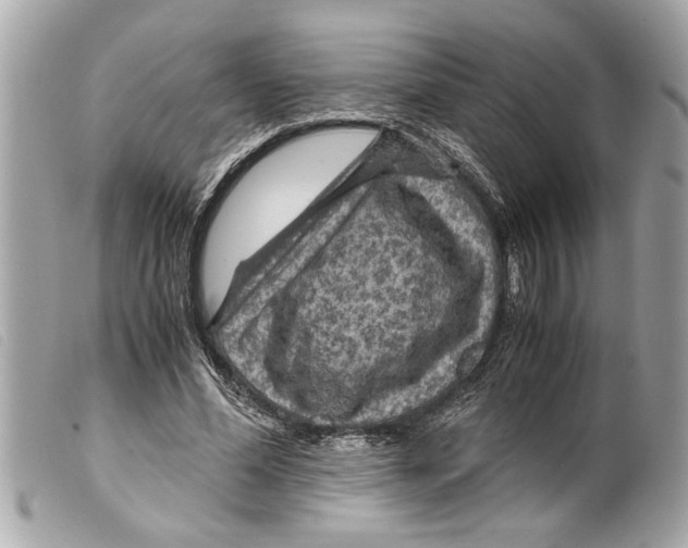 X0000099290588200805301114