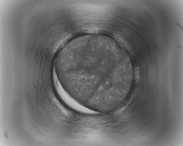 X0000099290589200805301114