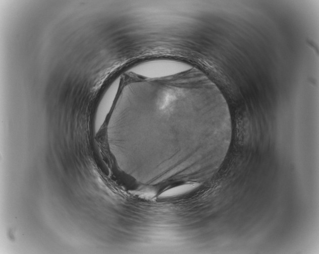 X0000099290592200805301113