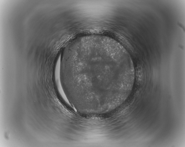 X0000099290593200805301113