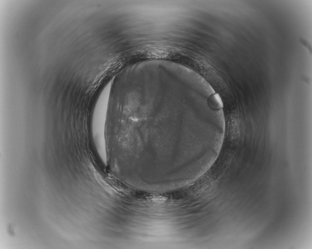 X0000099290598200805301113