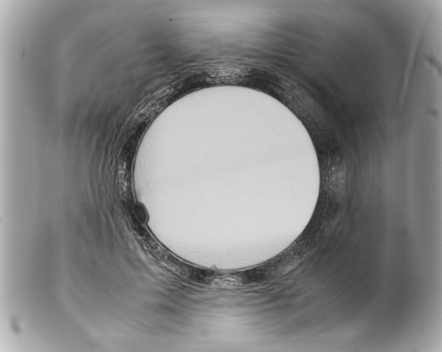 X0000099290599200805301113