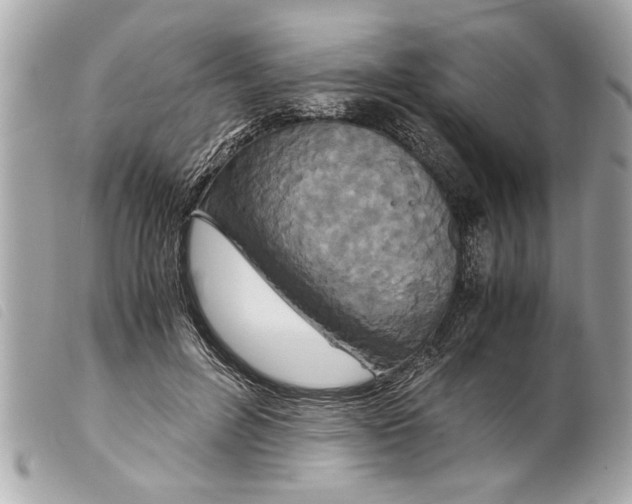 X0000099290600200805301113