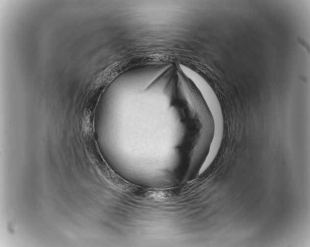 X0000099290611200805301113