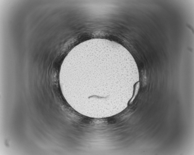 X0000099290619200805301113