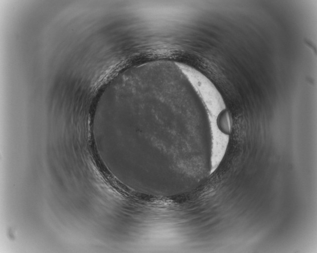 X0000099290642200805301113