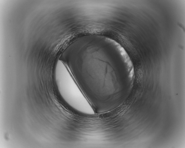 X0000099290644200805301113