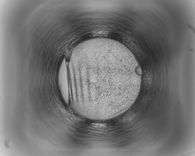 X0000099290649200805301113