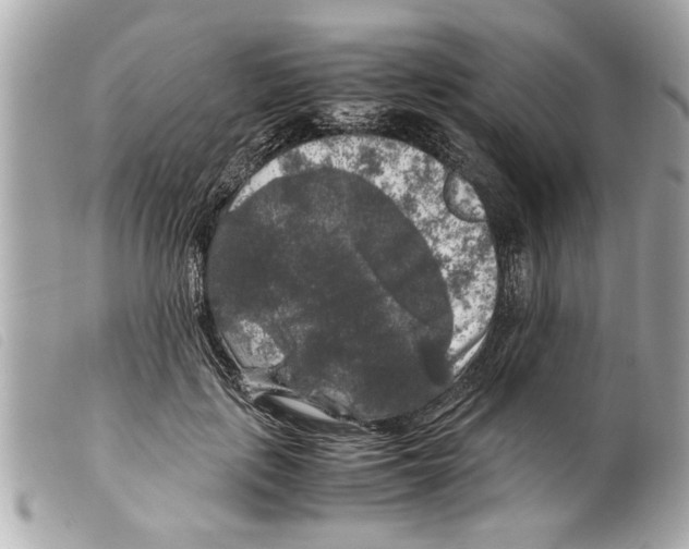 X0000099290651200805301113