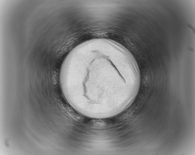 X0000099290658200805301113