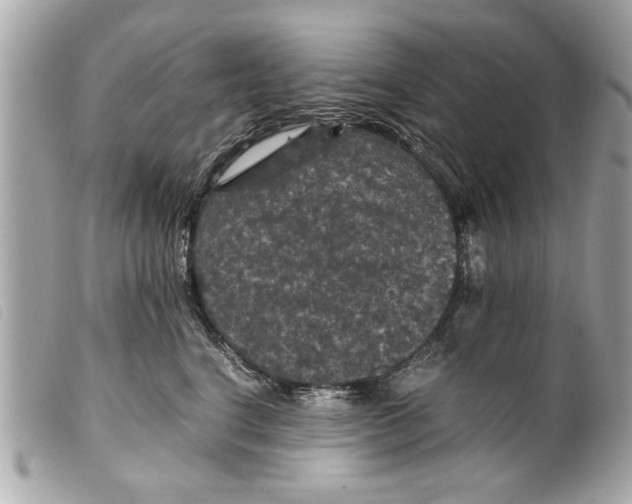 X0000099290664200805301113