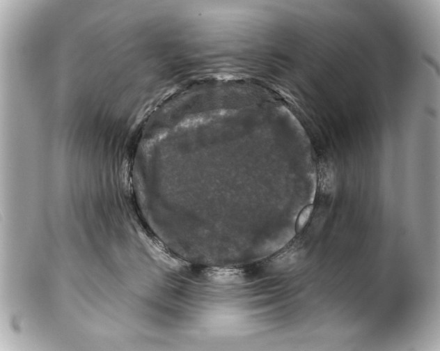 X0000099290670200805301113