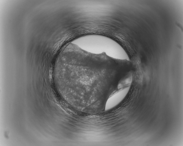 X0000099290691200805301112