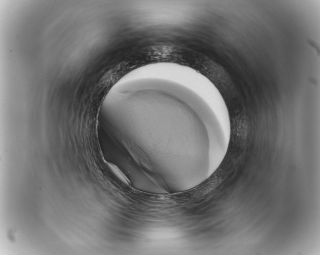 X0000099290754200805301111