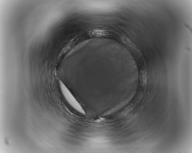 X0000099290760200805301111