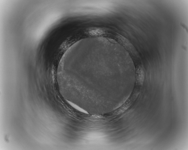 X0000099290762200805301111